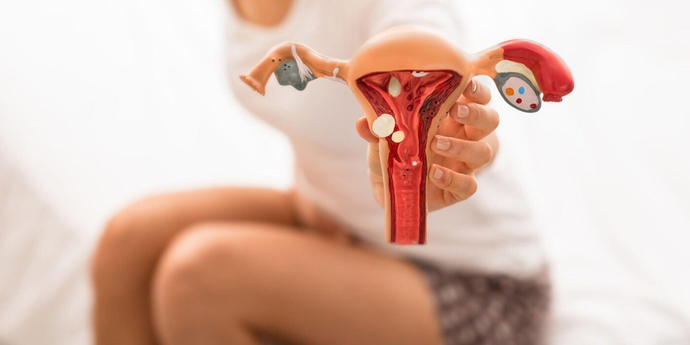 Can You Get A Medical Marijuana Card For Endometriosis?
