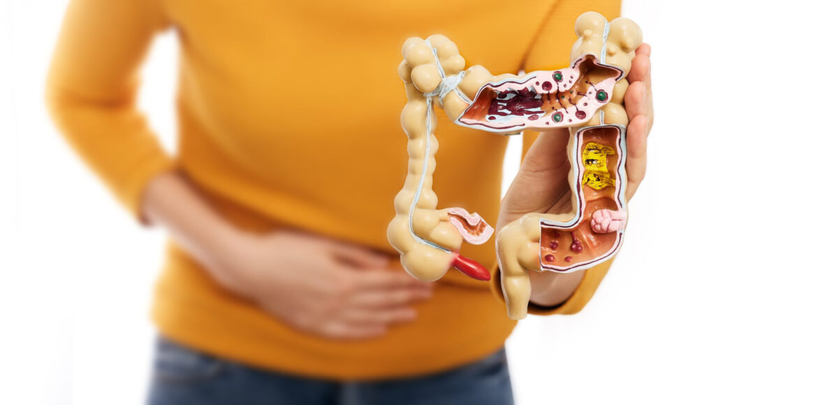 Best Cannabis Strains for Crohn’s Disease: 2025 Guide